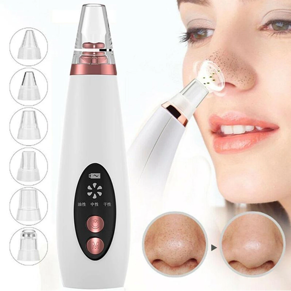 Official As Seen On TV Derma Suction Facial Pore Vacuum by  kit , Blackhead Extractor Cleans Pores Painlessly & Gently Without Squeezing - Canadian Edition